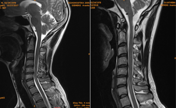 LM_Novosti_DNS_napredak